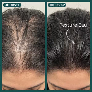 Protocole Activation Marine™ : Traitement Anti-Chute & Densité