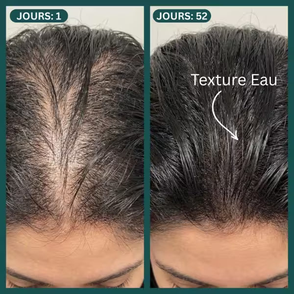 Protocole Activation Marine™ : Traitement Anti-Chute & Densité