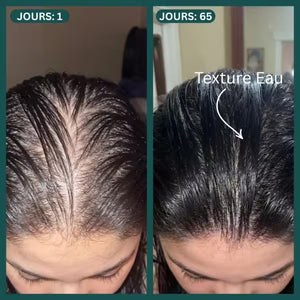 Protocole Activation Marine™ : Traitement Anti-Chute & Densité