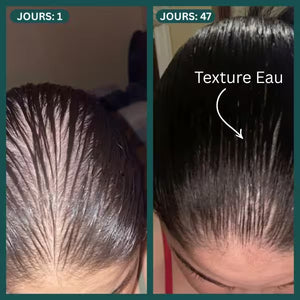 Protocole Activation Marine™ : Traitement Anti-Chute & Densité