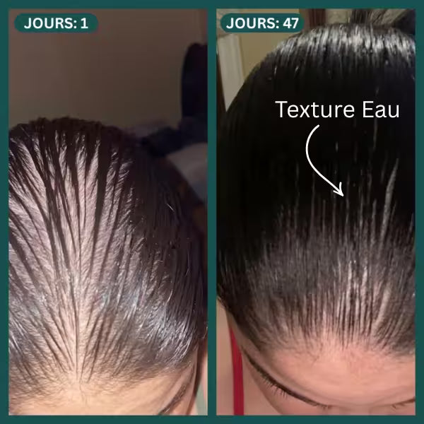 Protocole Activation Marine™ : Traitement Anti-Chute & Densité
