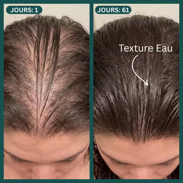 Protocole Activation Marine Karamats : shampooing anti-chute et sérum fortifiant pour cuir chevelu